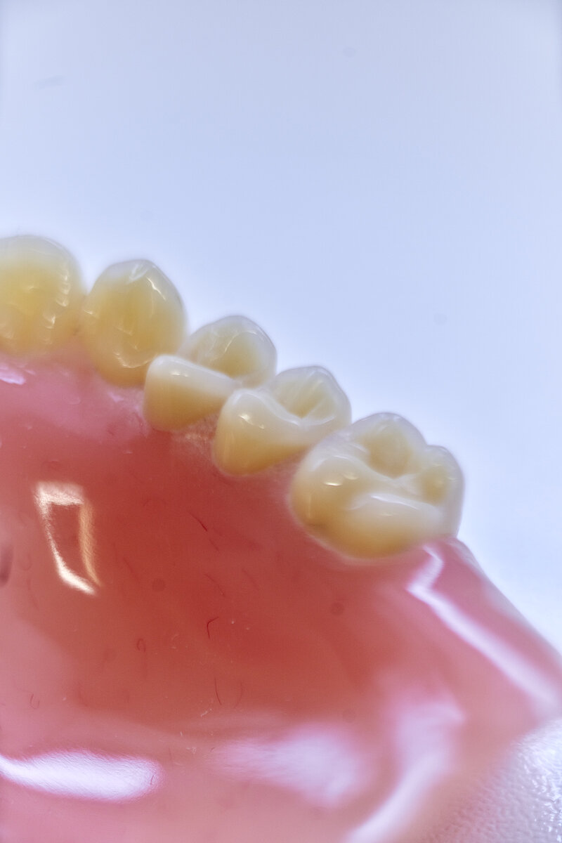 Zahnersatz Forner & Otten